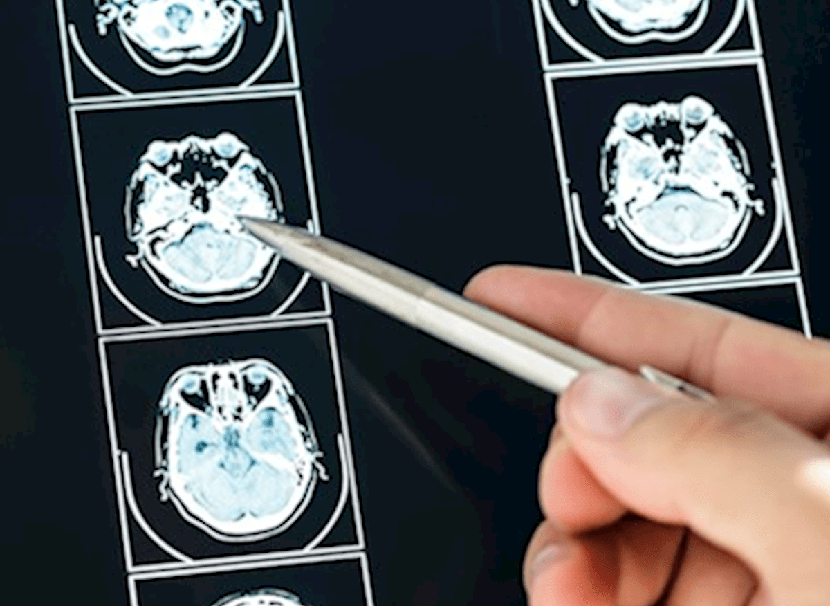 Functional Cognition Explained